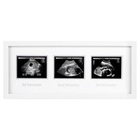 Pearhead Triple Sonogram Frame, White