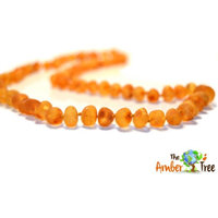 Maple RAW Baltic Amber Necklace