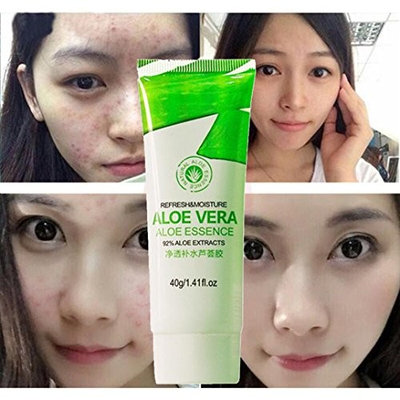 Anti Acne Cream - Fheaven Aloe Vera Gel Acne Remove Vanishing Dispelling Plaster Cream Skin Care Beauty