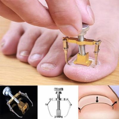 New Nail Orthosis Appliance Pedicure Foot Nail Care Toe Fixer Recover Correction Aphe