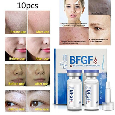 ZHUOTOP 10PCS/set Repair Skin Serum Acne Scar Removal Acne Treatment Acne Pimples Blackhead Remover 10pcs BFGF