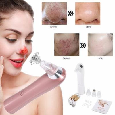 TMISHION Electric Vacuum Blackhead Suction Remover Acne Blackhead Extractor Skin Pore Cleaner Facial Beauty Machine