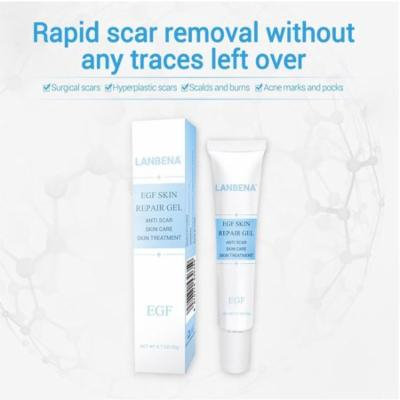 Details about LANBENA Face Acne Treatment Cream Anti Acne Scars Spot Removal Gel Stretch Marks