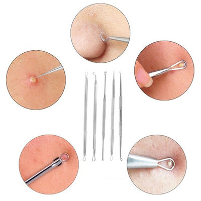 YEISEE Stainless Steel Blackhead Remover Kit Pimple Comedone Acne Blemish Whitehead Extractor Tool Set Treatment(Needles Set 5pc)