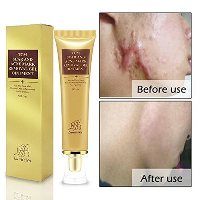 Acne Scar Removal Cream,Skin Repair Face Whitening Gel Cream for Spots Marks Acne Spots Scar Blackhead Stretch Marks 30g