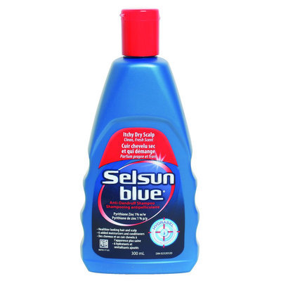Selsun Blue for Itchy Dry Scalp