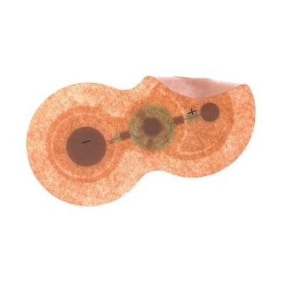 IontoPatch Extra Strength™ Iontophoresis with Vial Venting Delivery System
